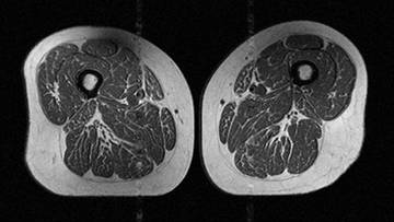 2026-04-19 Ludzkie udo jak stek. Tak zmienia nas popularna żywność